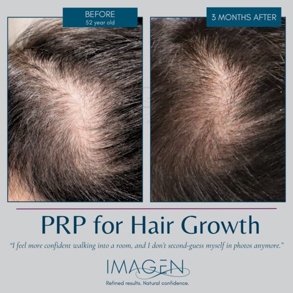 Hair Restoration Omaha