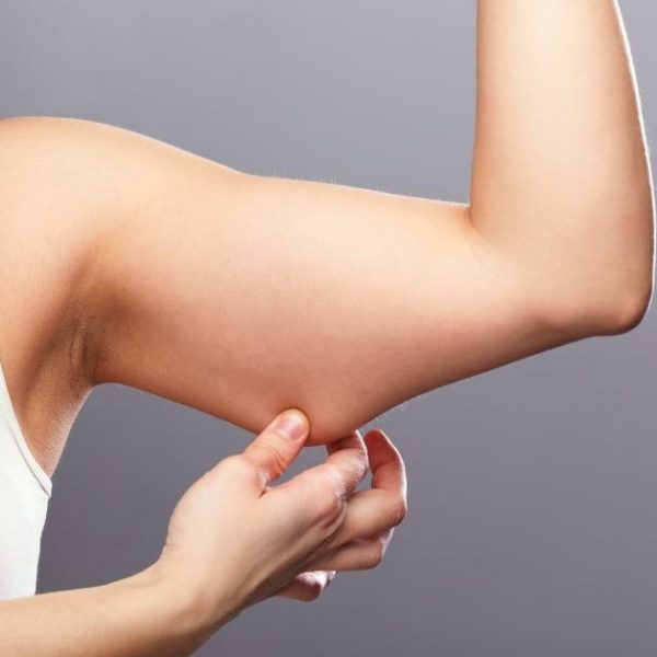 Woman holding her arm fat