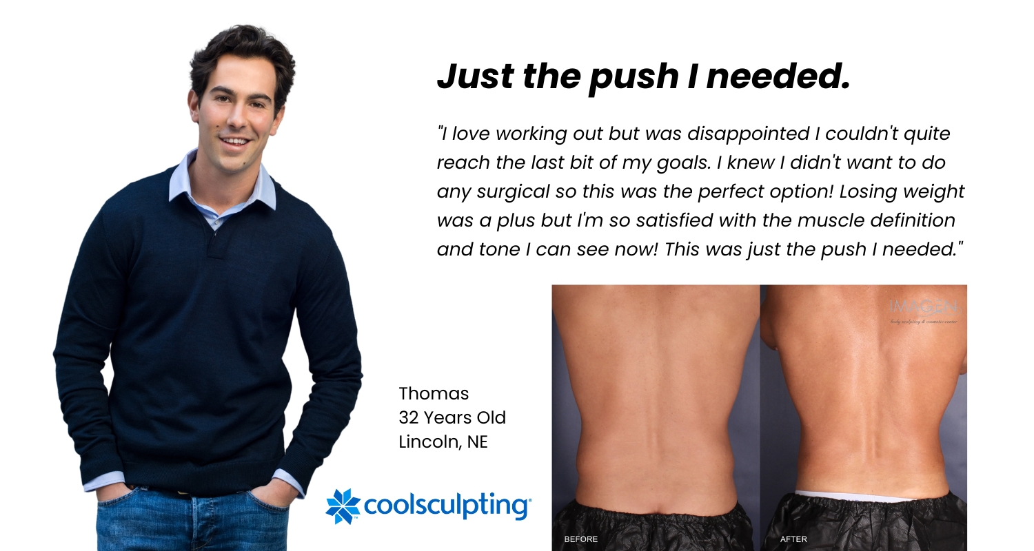 Omaha, NE CoolSculpting for men before and after CoolSculpting Omaha