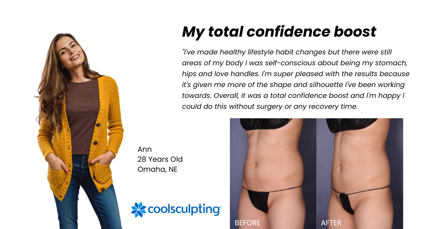 Omaha nonsurgical fat removal before and after CoolSculpting Omaha