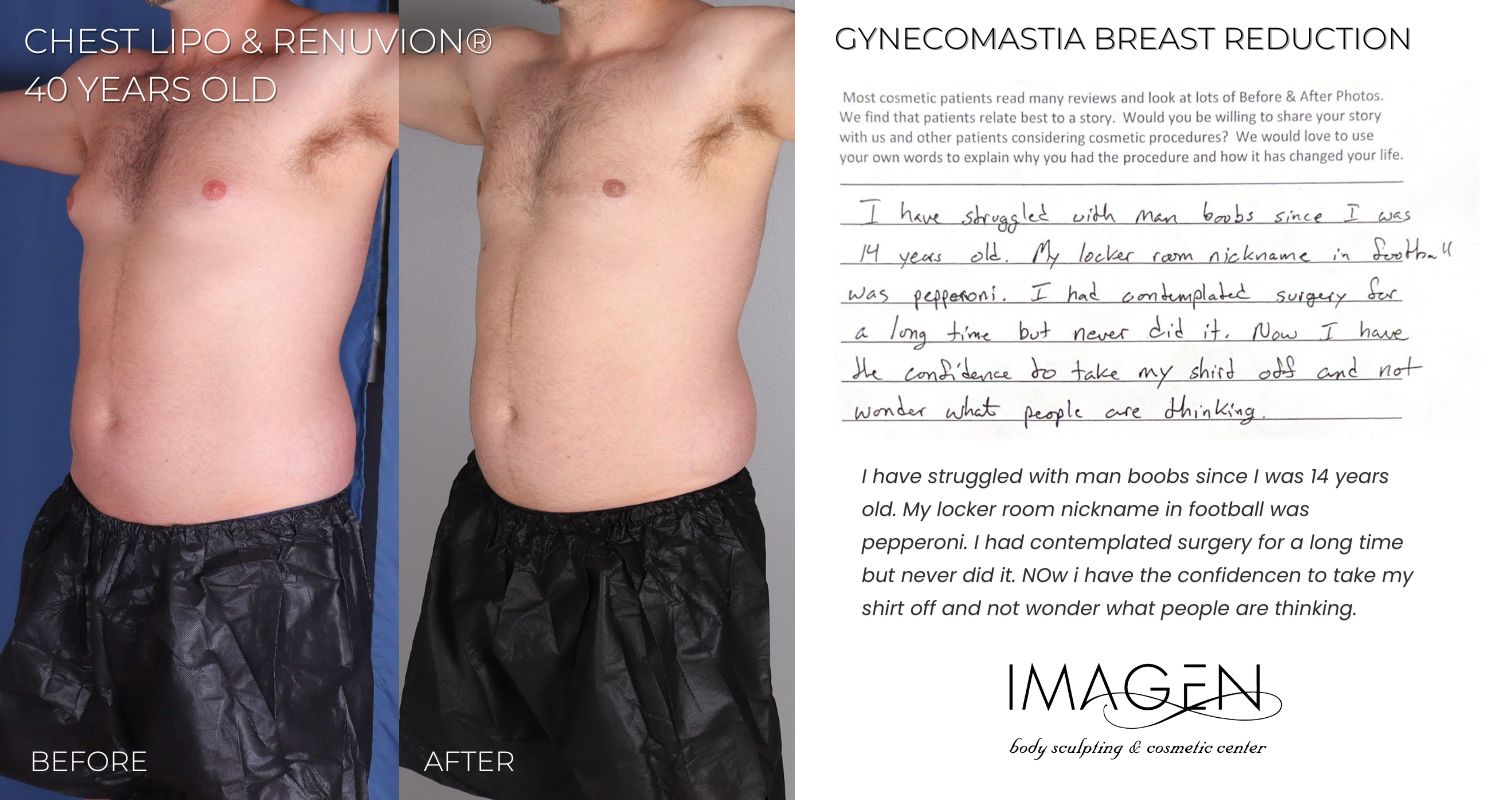 2023 Omaha Cosmetic Surgery Imagen Gynecomastia Breast Reduction lipo 360 laser Sono bello Nebraska Mens Liposuction