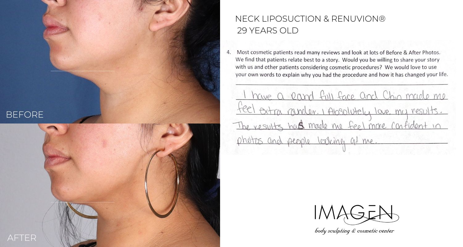 2023 Omaha Cosmetic Surgery Imagen Body Sculpting lipo 360 laser Sono bello Nebraska liposuction neck chin renuvion omaha nebraska