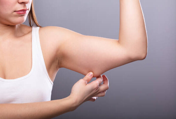 CoolSculpting Arms Omaha